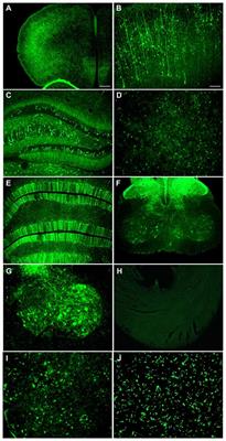 Better Targeting, Better Efficiency for Wide-Scale Neuronal Transduction with the Synapsin Promoter and AAV-PHP.B